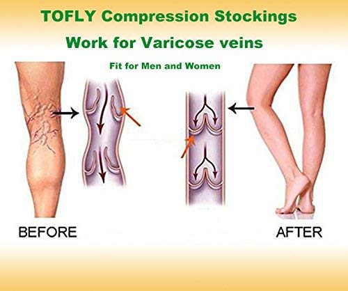 TOFLY® Compression Stockings (Pair), Medical Grade Firm Support 20-30mmHg, Opaque, Unisex, Close-Toe Knee High Compression Socks for Varicose Veins, Edema, Shin Splints, Nursing, Travel, Beige L