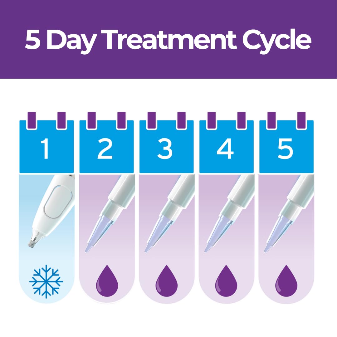 Excilor Warts Duo Power Treatment - Extra Strong Effective Wart Verruca Removal - 2 Devices in 1 Box - Cryo Freeze & Acid Treatment - Hands & Feet - Effective from Day 5 - Clinically Proven