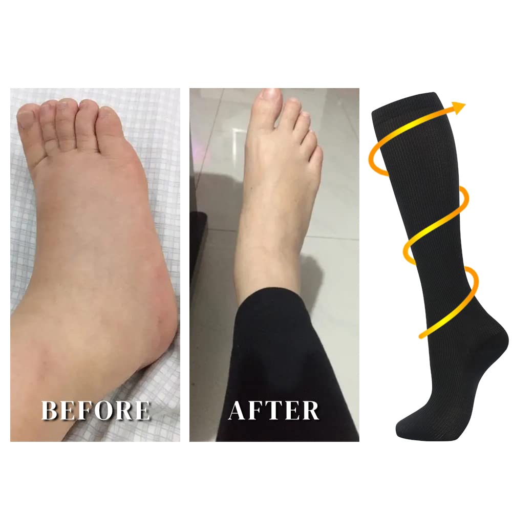 7 Pairs Compression Socks for Women & Men 15-20 mmHg is Best Athletic & Medical for Running Flight Travel Nurses