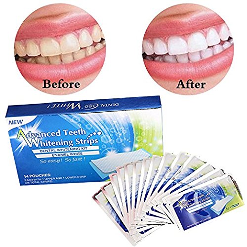 KAV PLUS 56 Professional Teeth Whitening Strips – Advanced Enamel-Safe Bleaching Strips for Sensitive Teeth, Home Whitening Kit for a Brighter Smile