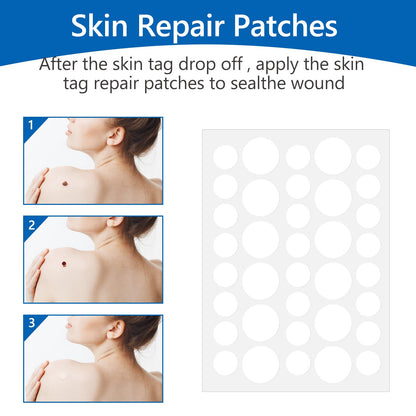 Skin Tag Removal - Auto Skin Tag Remover Pen Kit with 60 Micro and Regular Skin Tag Bands, Fast and Easy Remover Wart and Mole(1mm-9mm), for Face and Body, with 36 Skin Tag Removal Repair Patches