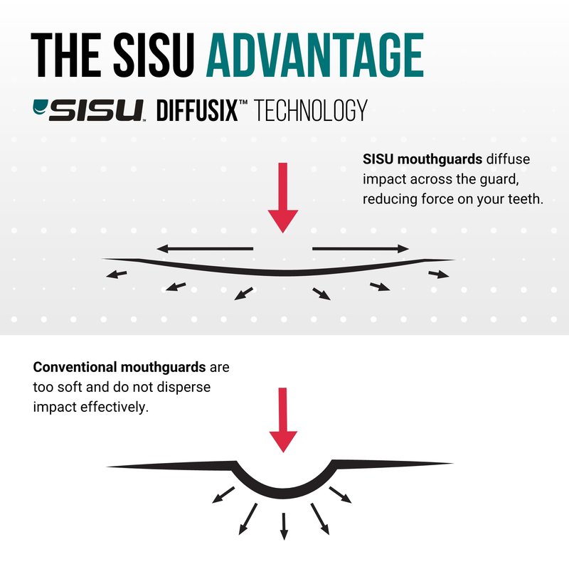 SISU Max Mouthguard, Neon Flash - 50% Stronger, Maximum Protection for Rugby, MMA, Boxing, Lacrosse, Football, Hockey, High-Impact Sports - Adult Fit, Remoldable Up to 20 Times, Works for Braces