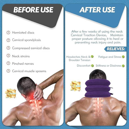 Jaximy Neck Stretcher, Neck Traction Device, Cervical Traction Device, Neck Pain Relief, Adjustable Inflatable Neck Brace & Neck Stretcher Cervical Traction, Neck Decompression Home Use (Purple)
