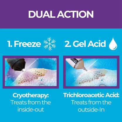 Excilor Warts Duo Power Treatment - Extra Strong Effective Wart Verruca Removal - 2 Devices in 1 Box - Cryo Freeze & Acid Treatment - Hands & Feet - Effective from Day 5 - Clinically Proven