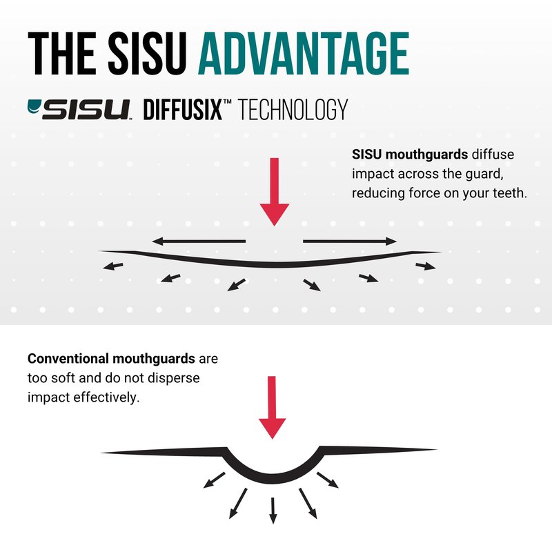 SISU Tether Adult Mouthguard, Intense Red - Pre-Formed Protection with Strap for Football, Hockey, Lacrosse, Caged-Helmet Sports - Remoldable Up to 20 Times - Works for Braces - Non Toxic