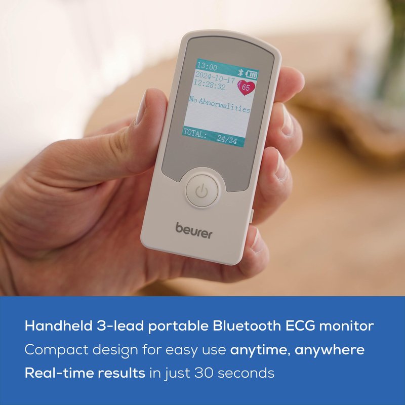Beurer Cardio Companion EKG Monitor - 3-Lead Portable ECG Machine, Detects Irregular Heart Rhythms, Fast Results in 30 Seconds, Bluetooth with App, Rechargeable Battery, FSA/HSA Eligible, ME75