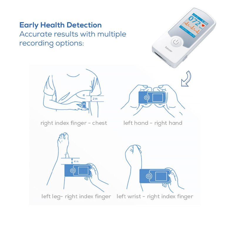 Beurer Cardio Companion EKG Monitor - 3-Lead Portable ECG Machine, Detects Irregular Heart Rhythms, Fast Results in 30 Seconds, Bluetooth with App, Rechargeable Battery, FSA/HSA Eligible, ME75