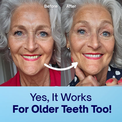 MySweetSmile Dentist-Approved Teeth Whitening Powder - IndyBest Award-Winner - Enamel-Safe & Sensitivity-Free - Cool Mint Flavour - Removes Years of Stains - 6 Month Teeth Whitener Supply