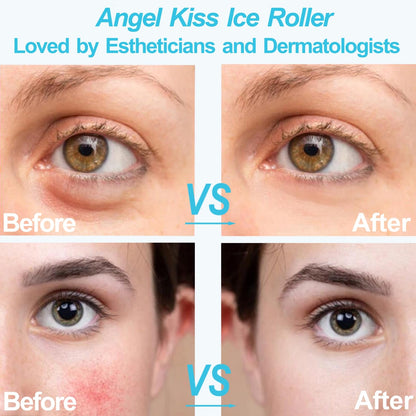 Angel Kiss Ice Roller for Face and Eye - Reduce Puffiness, Migraine, Pain and Minor Injury Relief, Ice Facial Roller Massager Cold Therapy, Self Care Product, Recommended by Esthetician w/Storage Case