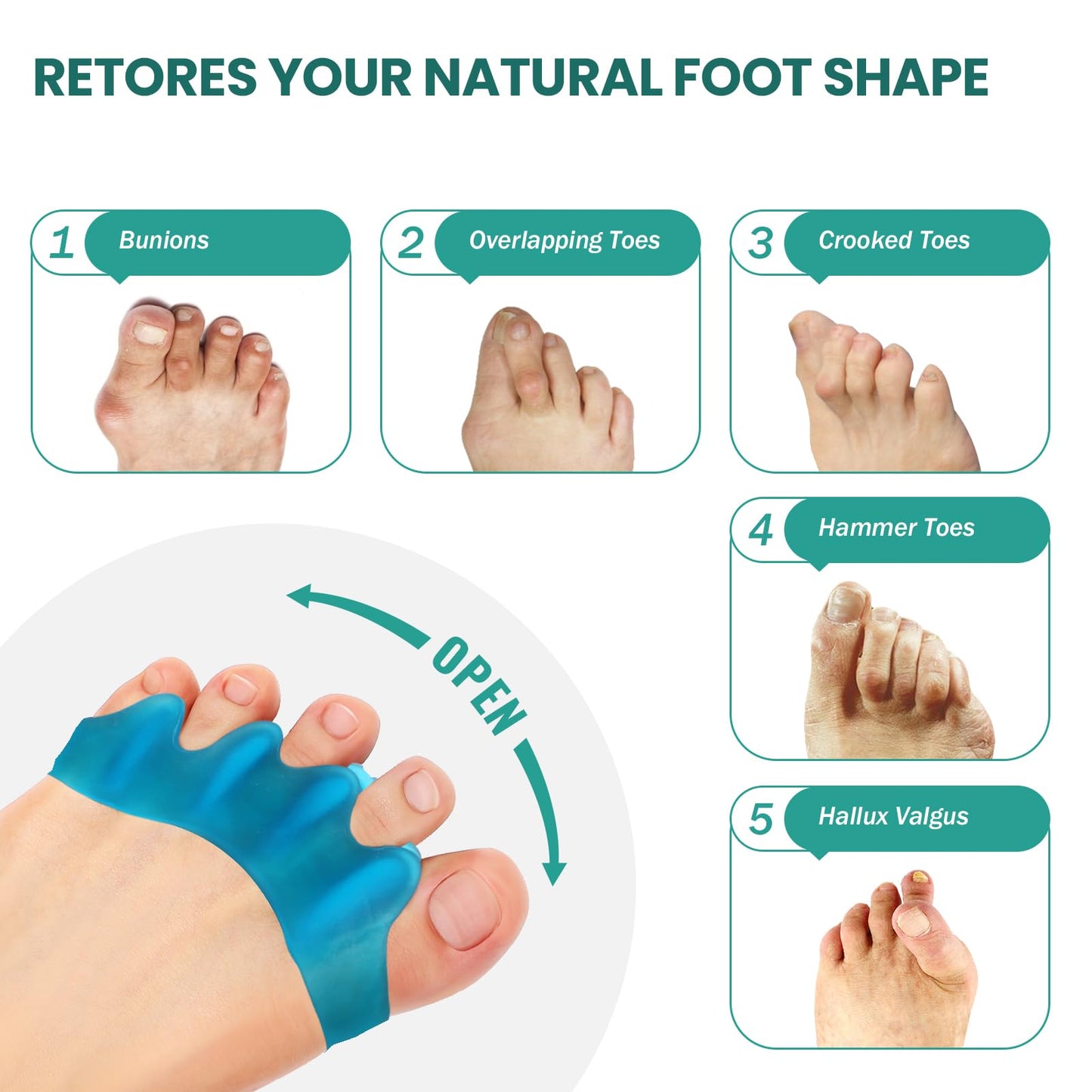 Welnove 8 Pack Toe Separators, Bunion Corrector for Women/Men, Toe Spacers, Foot Alignment - Dividers to Correct Bunions, Hammertoes, Relief Restore Feet (Blue)