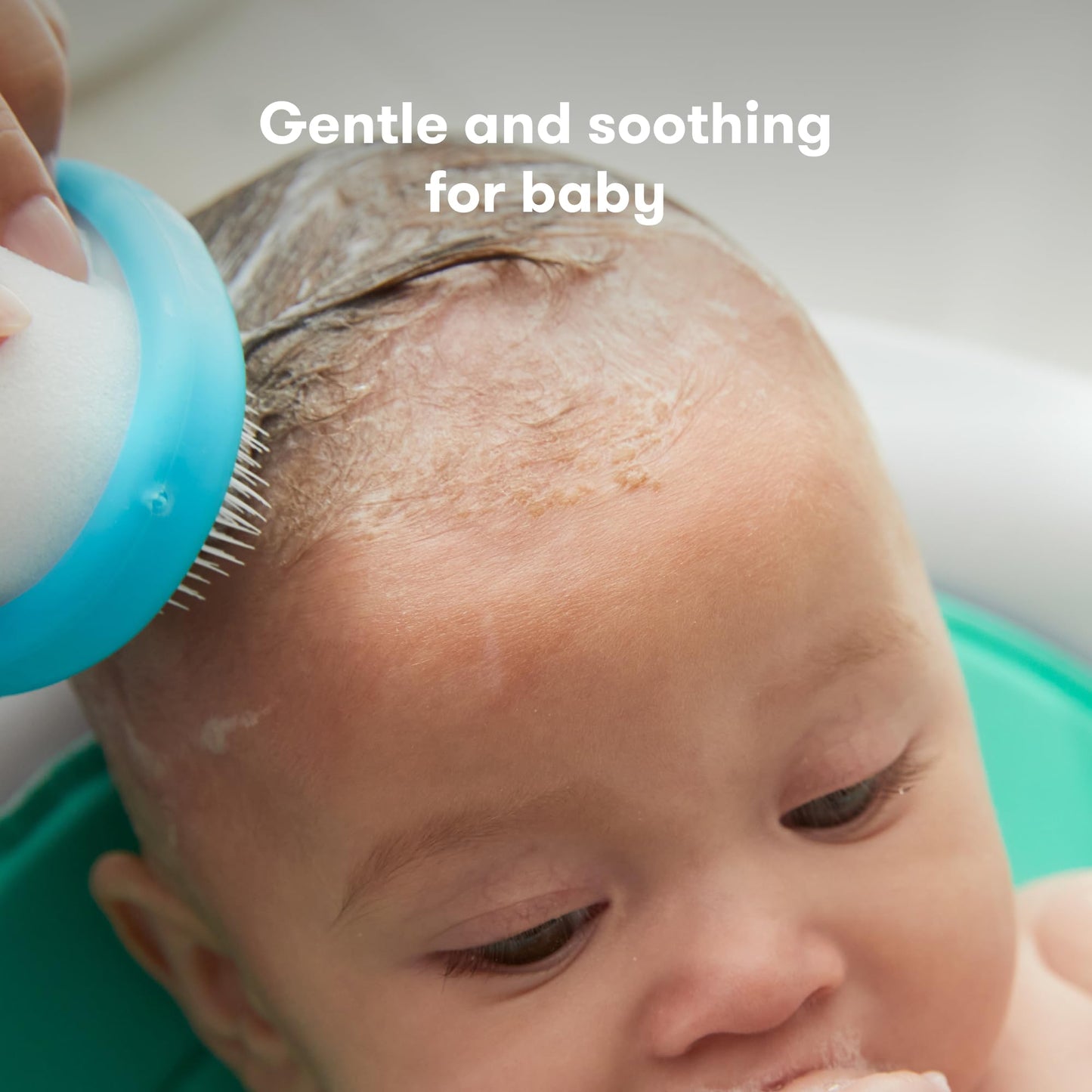 FridaBaby DermaFrida the FlakeFixer Cradle Cap Treatment System: 3-Step Cradle Cap Kit, Soothes Baby's Scalp, Prevents Dryness and Flakes, Sponge, Brush, and Comb + Storage Stand