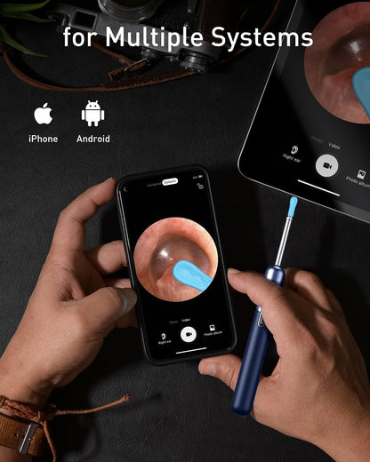 Ear Wax Removal - 3 in 1 Wireless WiFi Rechargeable Ear Cleaner, FSA Eligible Items Only List, 1080P HD Camera Lens & 7 Pcs Ear Set, Ear Cleaning Kit with 15 Replacement Tips, Blue