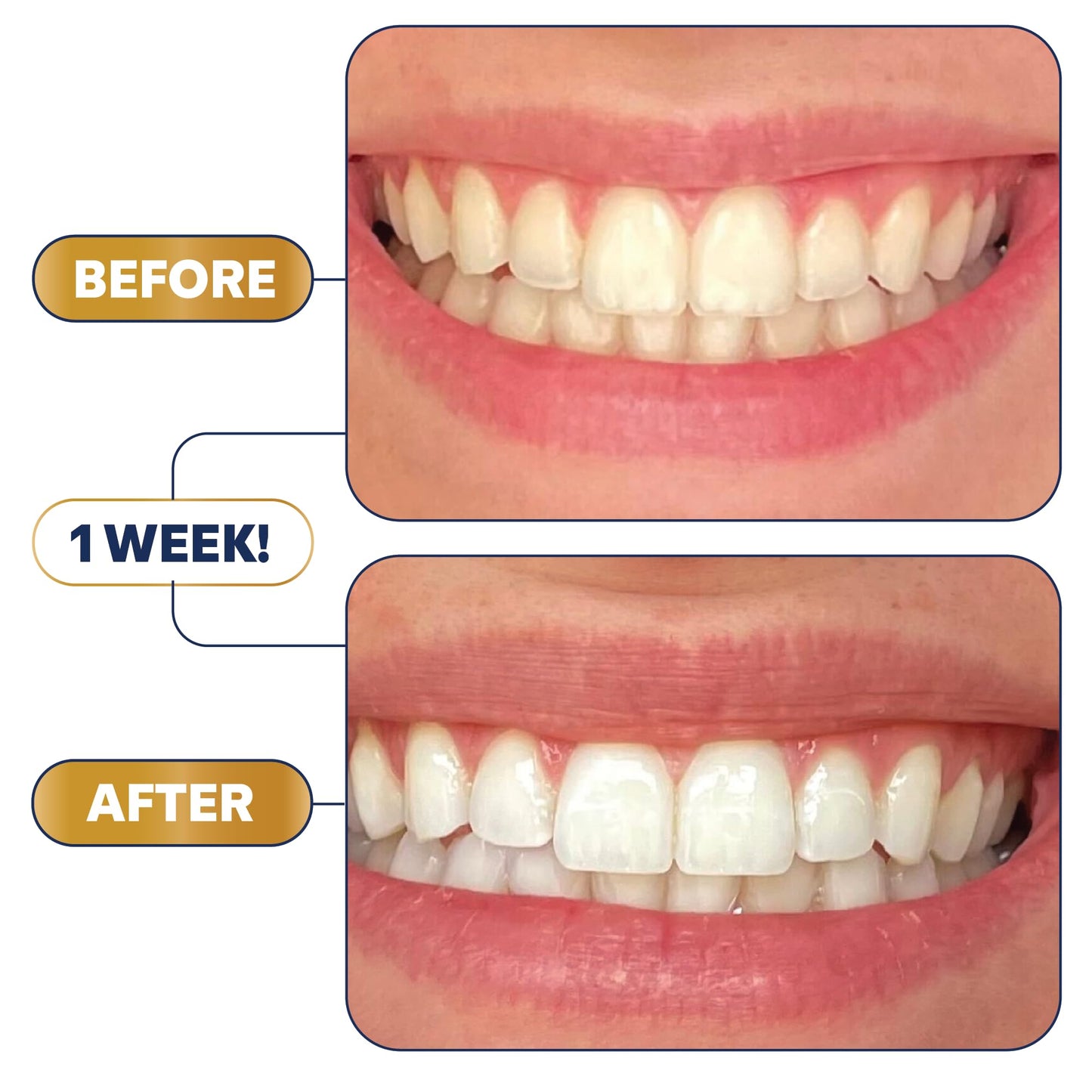 Oral Essentials Lumineux Teeth Whitening Strips- 21 Treatments Dentist Formulated and Certified Non Toxic - Sensitivity Free - NO Artificial Flavors, Colors, and SLS Free