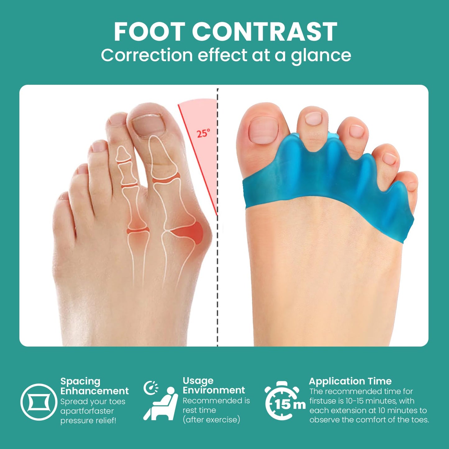 Welnove 8 Pack Toe Separators, Bunion Corrector for Women/Men, Toe Spacers, Foot Alignment - Dividers to Correct Bunions, Hammertoes, Relief Restore Feet (Blue)