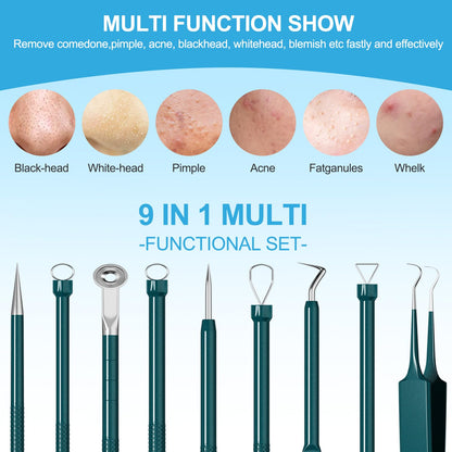 Pimple Popper Tool Kit Blackhead Remover Tools (5 Piece Kit), Professional Stainless Black Head Remover for face, Risk Free Treatment Pimple Extractor with Tweezers