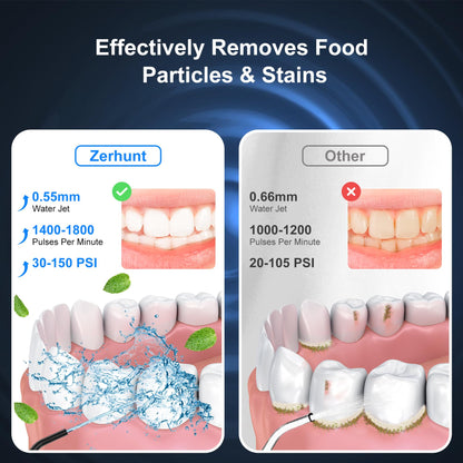 Water Flosser Pick for Teeth: 4 Modes Cordless Portable Water Flossers Teeth Cleaner Rechargeable 300ML IPX7 Waterproof Oral Irrigator Flossing Cleaning Picks for Home Travel