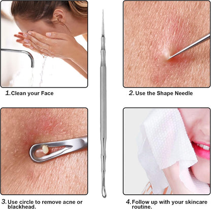 Pointed Blackhead Removal, 2-in-1 Acne Extractor Tool - Stainless Steel Whitehead Remover for Face/Nose