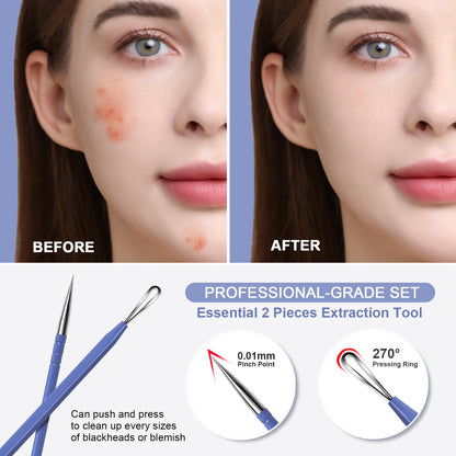Teenitor Pimple Extractor Acne Treatment Tool Surgical Grade Blackhead Comedone Removal 2-in-1 Popper Tool for Face Nose Blackhead Extractor Tool Silver