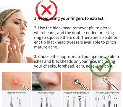2025 Professional Pimple Popper Tool Kit - 22 PCS Blackhead Remover Tools for Acne and Zit Popping Comedone Extractor with Magnifying Glass