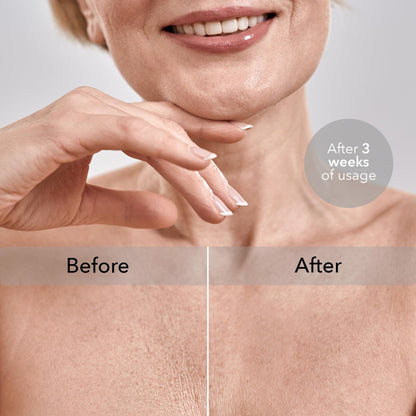 Intimia Breast Pillow for Chest Wrinkles and Side Sleeping - Chest Pillow for Wrinkle Prevention - Chest Wrinkle Pillow for Breast Support (Gold)