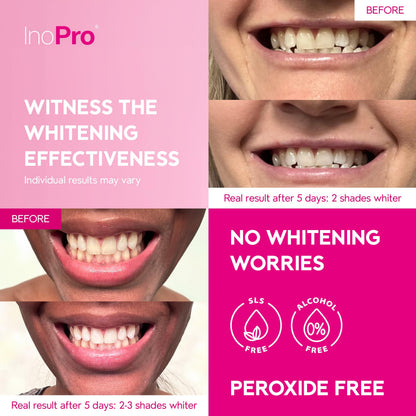 InoPro Teeth Whitening Strips 14 Treatments Kit - Teeth Whitener, Peroxide Free, Enamel Safe Green Whitestrips, Deep Stains Removal - Instant Teeth Whitening Without The Harm (28 Strips)