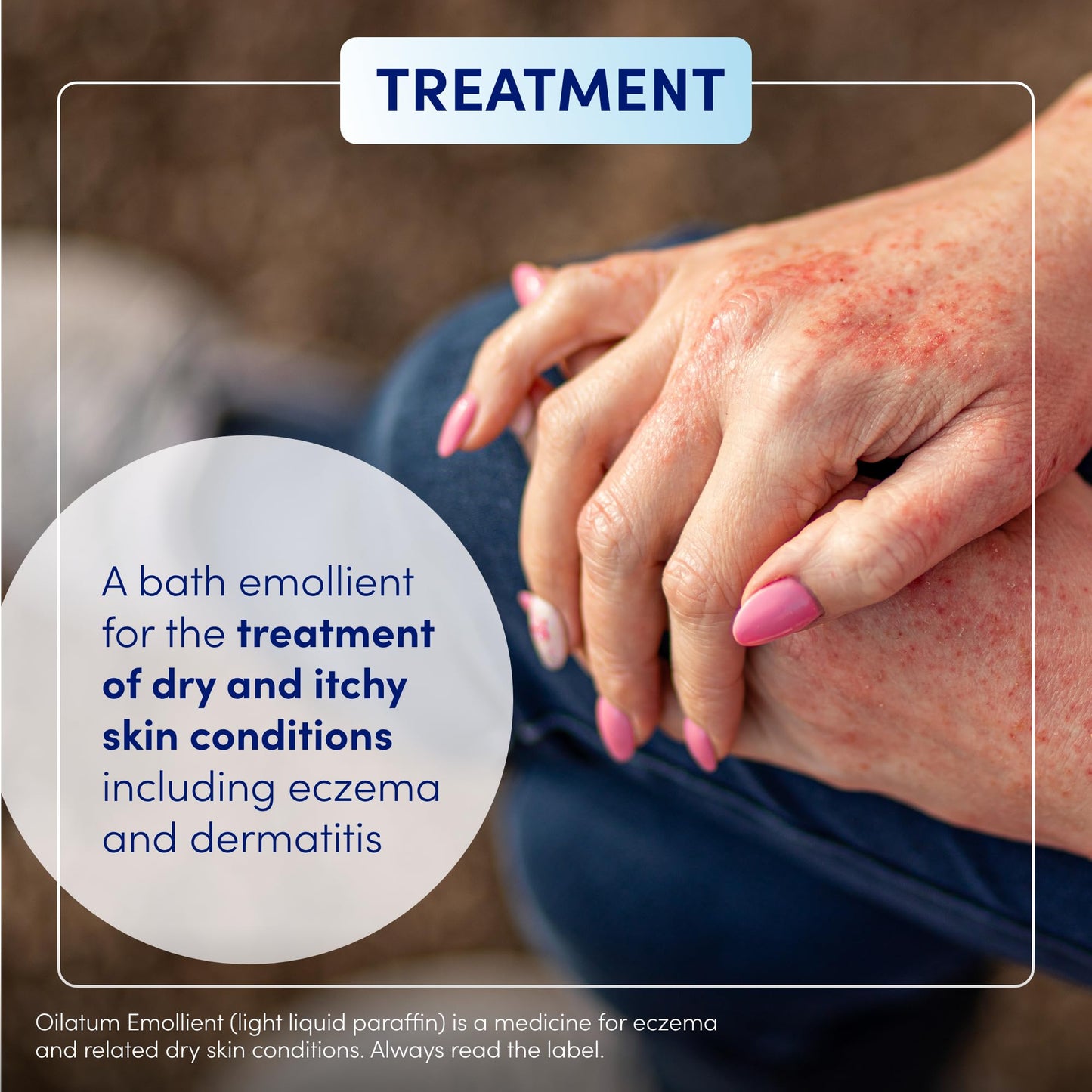 Oilatum Emollient Bath Liquid for Eczema, Psoriasis and Dry Skin Conditions, Soothing Formula for Sensitive Skin, Hydrating Relief for Itchy, Irritated Skin, 1 x 500ml