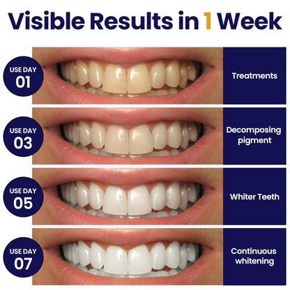 DENTELO Professional Teeth Whitening Strips,42 Non-Sensitive, Safe for Enamel, Anti Slip, Dentist Formulated Teeth Whitener Strips, Adavance Pap Whitening Stripes