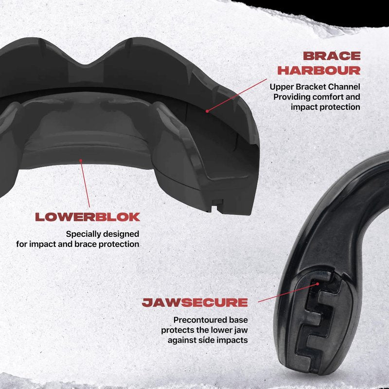 SAFEJAWZ Mouth Guard for Braces, Upper & Lower Protection Mouthguard with Case, Easy Fit Remoldable Mouthpiece for Football, Boxing, Lacrosse, MMA, Basketball & All Contact Sports (One Size, Black)