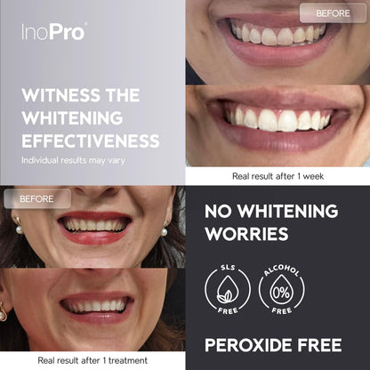 InoPro Natural Teeth Whitening Strips Kit, 14 Treatments Whitening for Sensitive Teeth, Peroxide Free, White Strips That Do Not Damage Enamel, Stain Removal