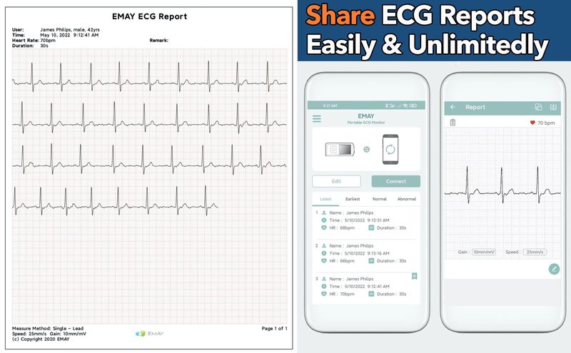 EMAY Portable ECG Monitor | Record ECG and Heart Rate | Compatible with Smartphone and PC