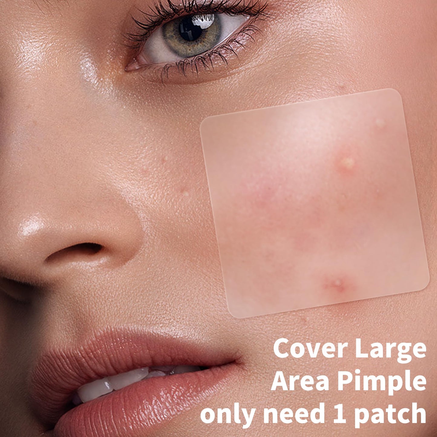 Pimple Patches for Face, 4 Size 300 Counts Acne Patches, Hydrocolloid Patches for Covering Zits and Blemishes, Spot Stickers with Salicylic Acid, Tea Tree Oil & Calendula Oil