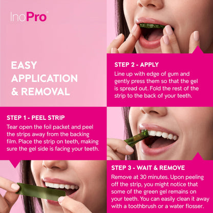 InoPro Teeth Whitening Strips 14 Treatments Kit - Teeth Whitener, Peroxide Free, Enamel Safe Green Whitestrips, Deep Stains Removal - Instant Teeth Whitening Without The Harm (28 Strips)