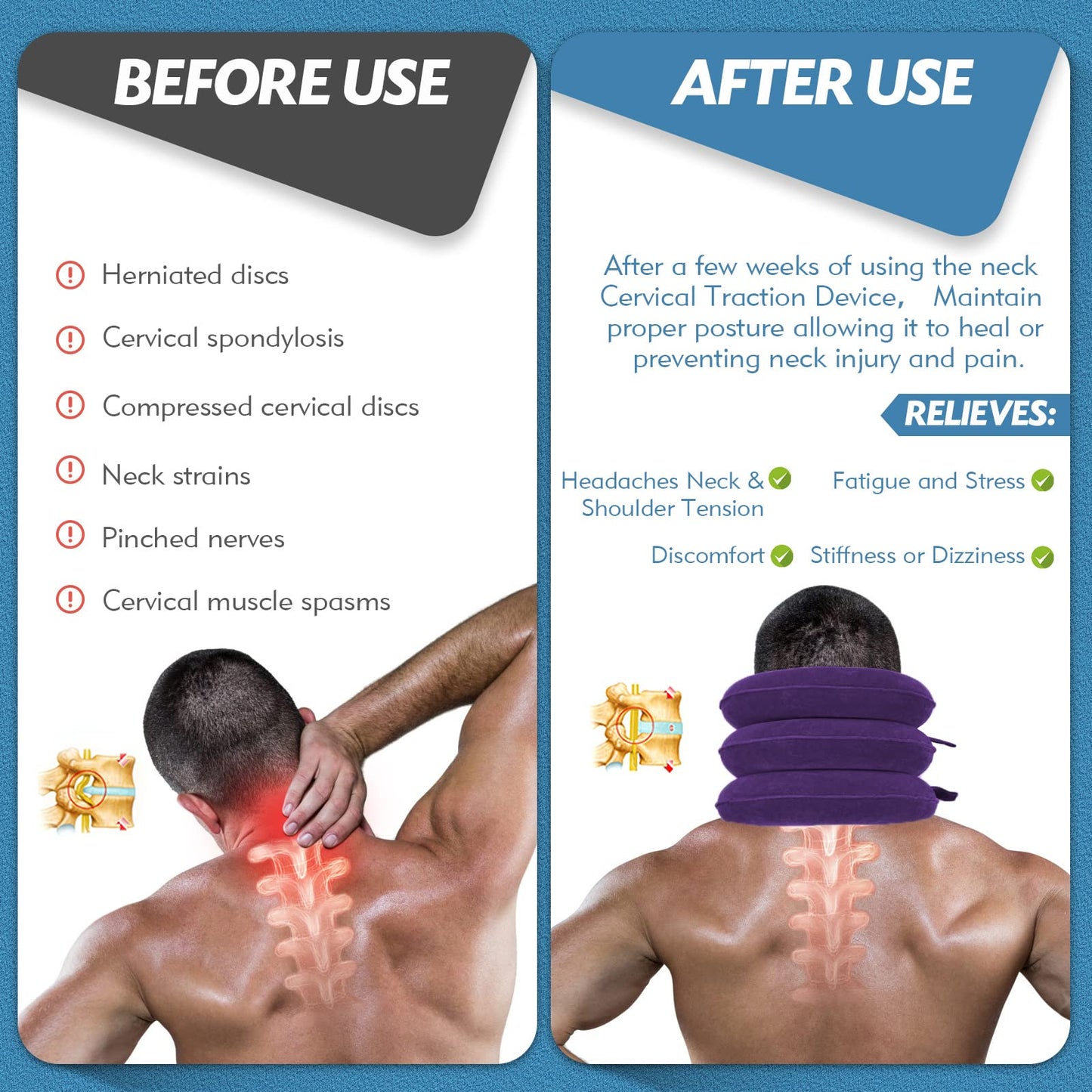 Jaximy Neck Stretcher, Neck Traction Device, Cervical Traction Device, Neck Pain Relief, Adjustable Inflatable Neck Brace & Neck Stretcher Cervical Traction, Neck Decompression Home Use (Purple)