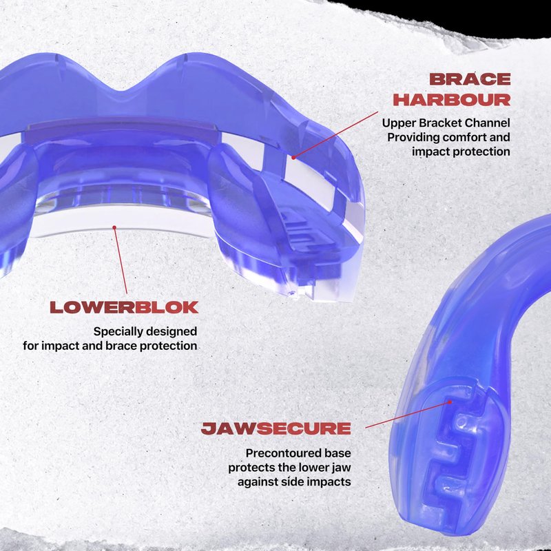 SAFEJAWZ Mouth Guard for Braces, Upper & Lower Protection Mouthguard with Case, Easy Fit Remoldable Mouthpiece for Football, Boxing, Lacrosse, MMA, Basketball & All Contact Sports (One Size, Ice Blue)