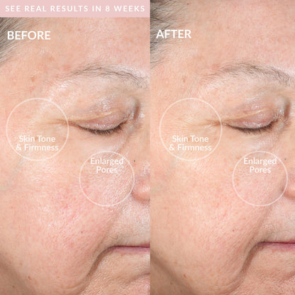 PMD Beauty Clean Pro OB - Smart Facial Cleansing Device